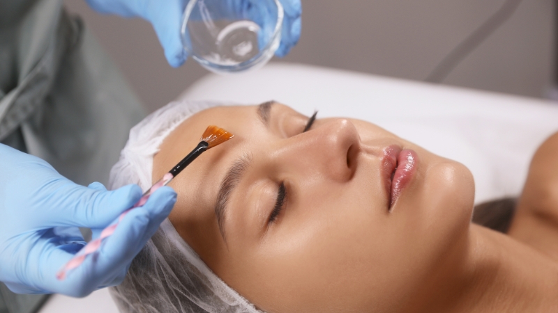 Professional Chemical Peeling Course