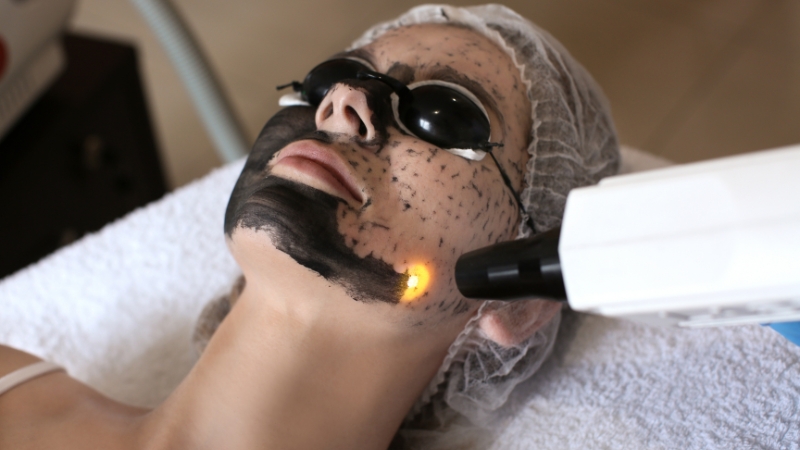 Carbon Laser Facial Course