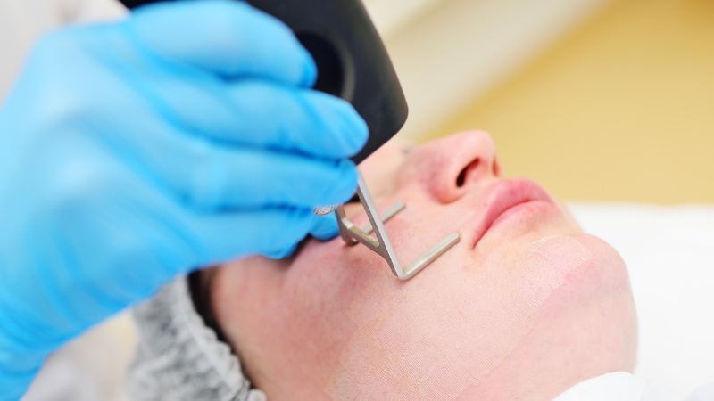 CO2 Fractional Laser Mastery